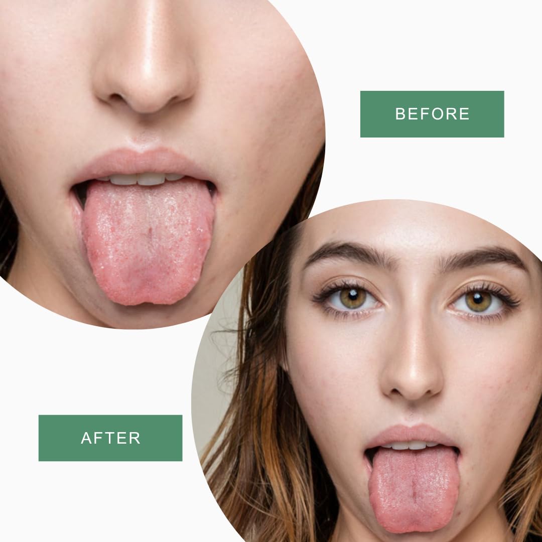 Metal Tongue Scraper for Adults with Travel Cases - 3 Pack, Tongue Cleaner for Adults with Travel Cases, 100% Stainless Steel Tongue Scraper for Bad Breath, Daily Hygiene, Oral Care