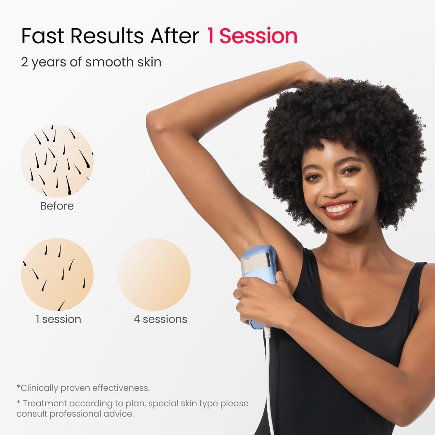 IPL Laser Hair Removal for Women and Men, 2 Lights, 2℃, 16.6 cm² Sapphire Ice Cooling for Sensitive Skin, 4-Pulse Mode for Ingrown Hair, Bikini, Face, Body Permanent Epilator Home Hair Removal Device