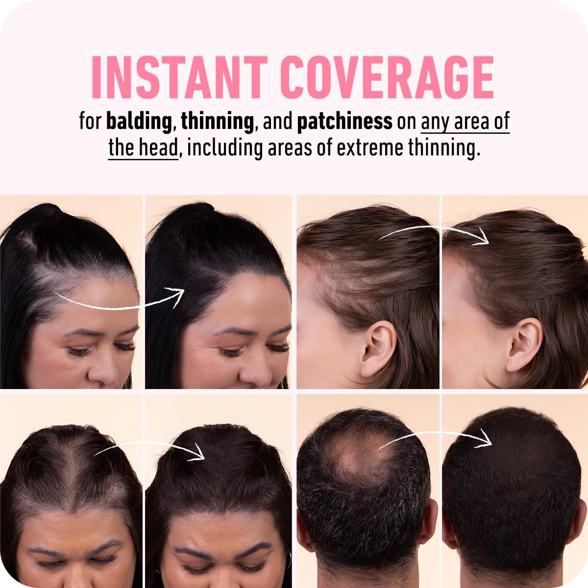 BOLDIFY Hairline Powder (LARGE, 10g) - Root Touch Up Hair Color for Gray Coverage - Bald Spot Concealing Hair Powder for Women & Men - 48-Hour Stain-Proof - Medium Brown