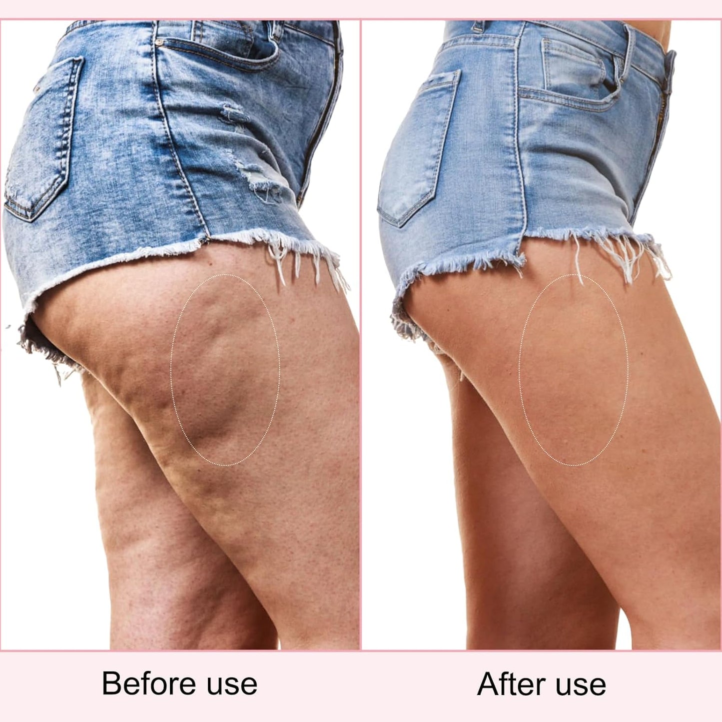 Butt Tight Lift Cream，Hip Firming Lifting and Firming Cream,Significantly Tighten the Leg Skin, Lift and Tighten the Body Cream to help Reduce the Appearance of Cellulite