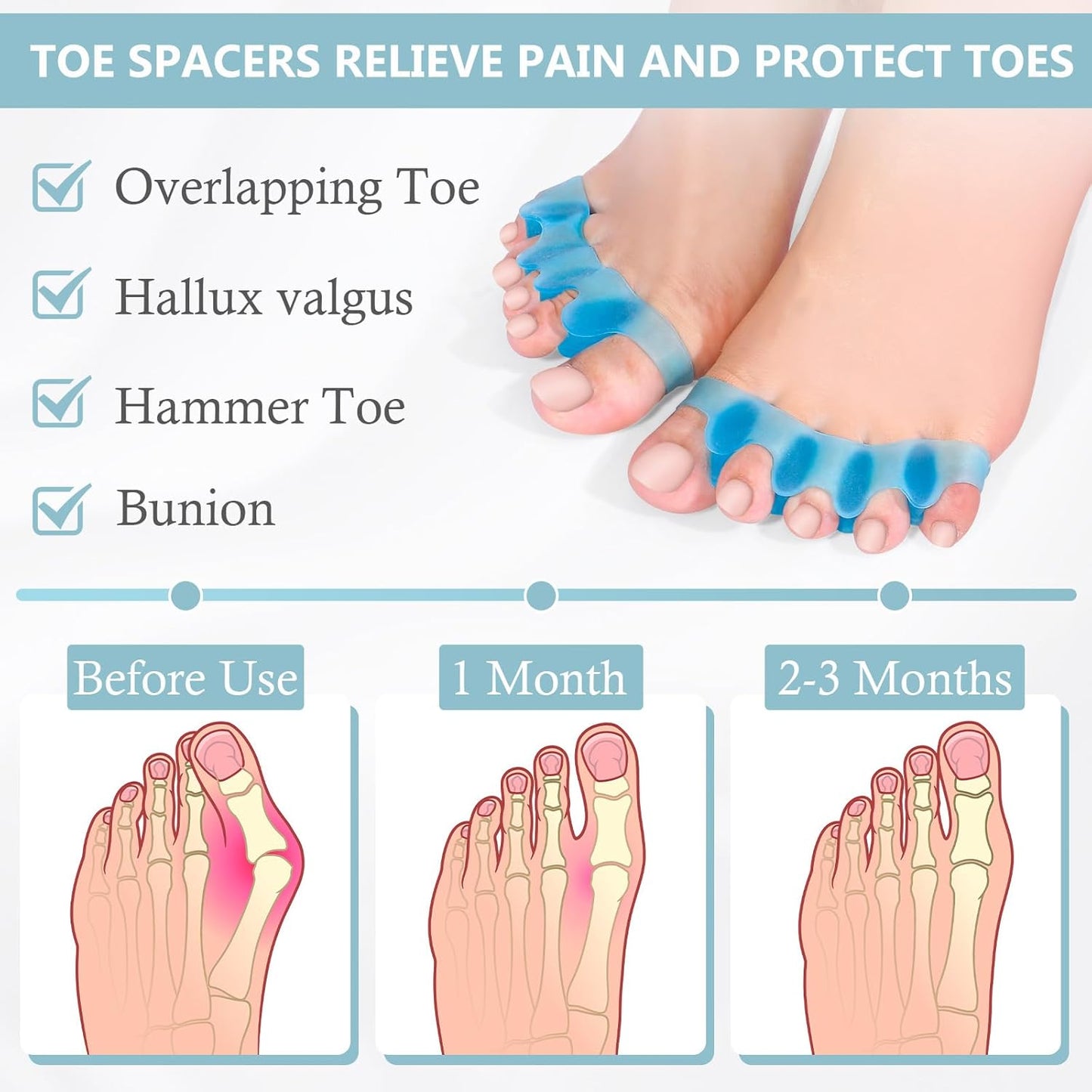 2PCS Toe Separators for Women and Men, Gel Toe Spacers for Pedicure and Foot Alignment, Comfortable Foot Care for Bunions and Overlapping Toes