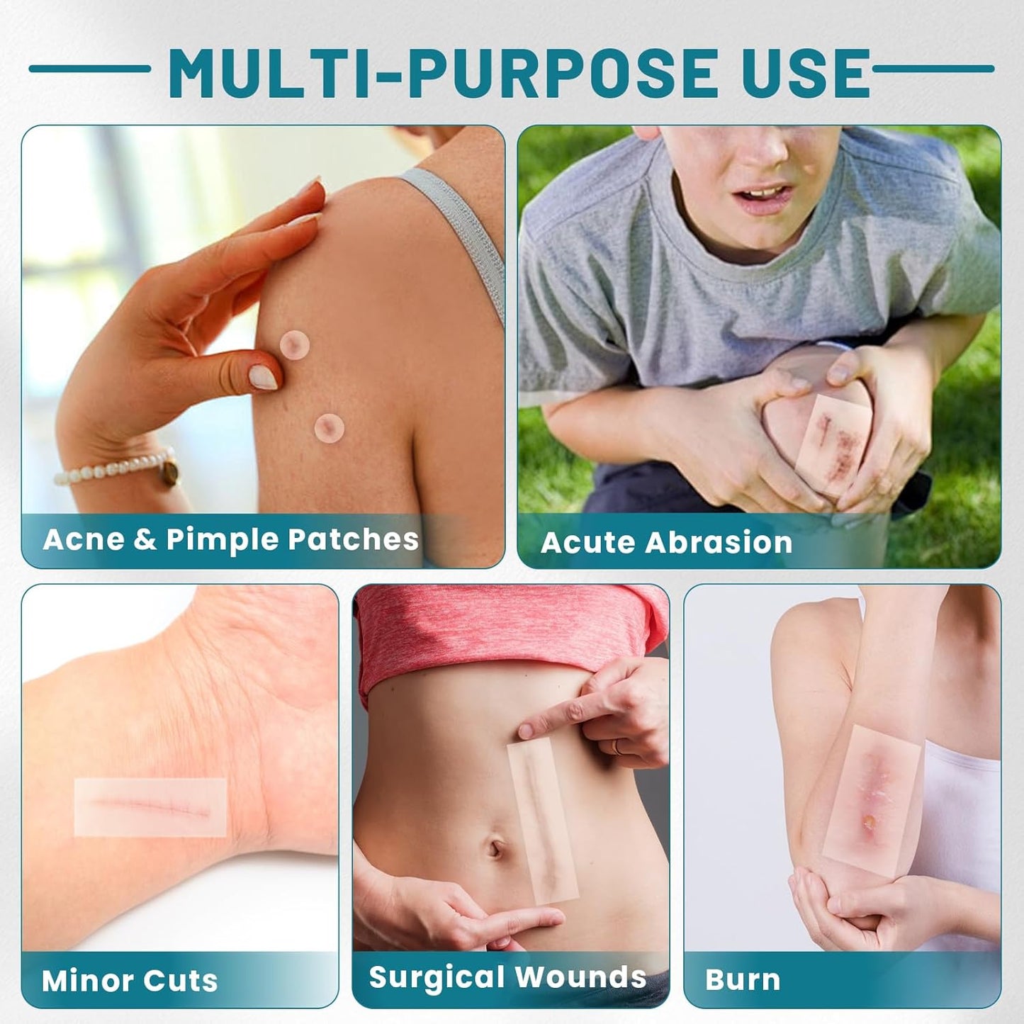 WUYUAN Hydrocolloid Roll for Wound Care, 2in*6.6ft Hydrocolloid Bandages with Self-Adhesive, Extra Large Hydrocolloid Patch Bandages Cut-to-Size, Ultra Absorbent, Waterproof