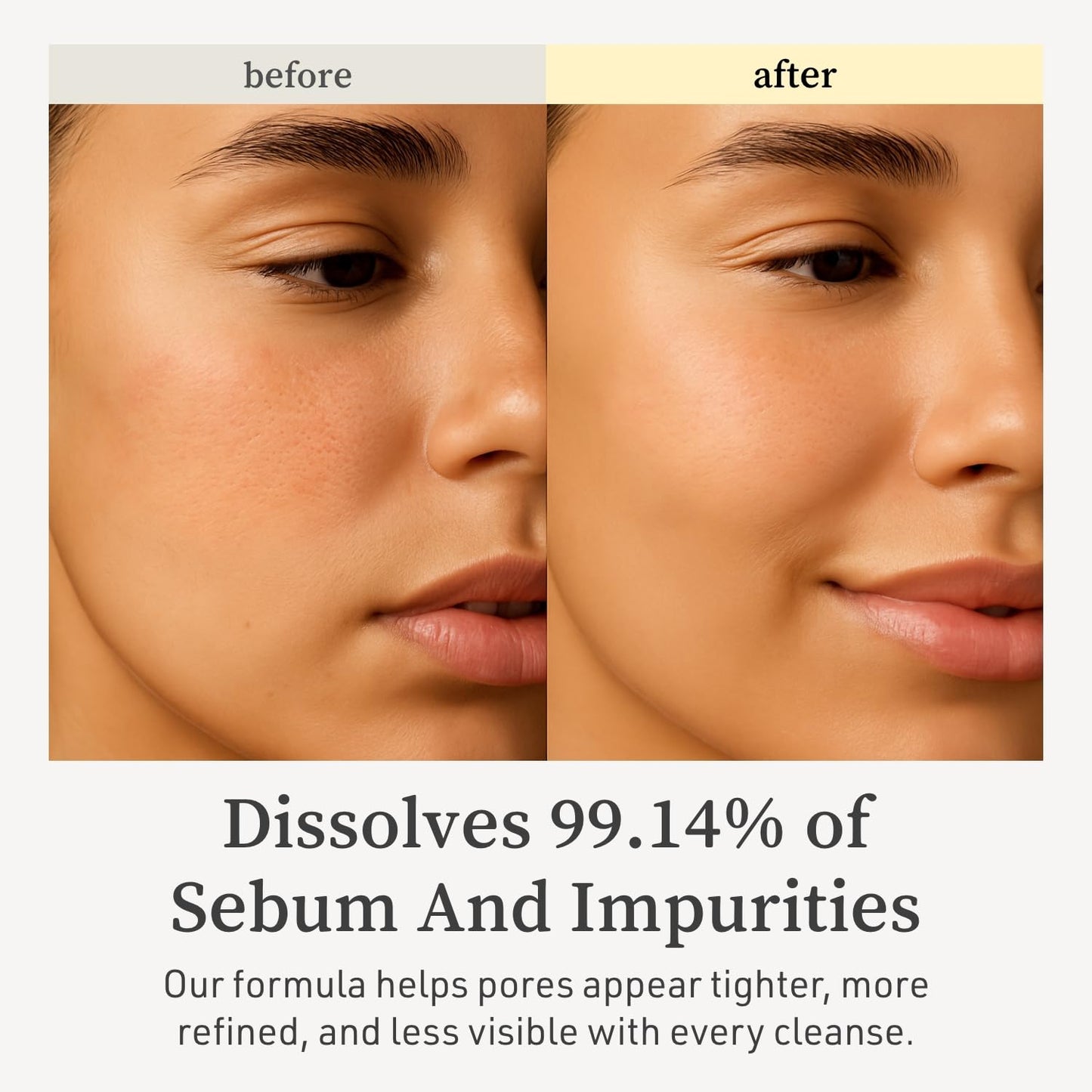 NOONI Facial Cleanser - Snow Aqua 0 LHA Toning Cleansing Oil *2ea | Makeup Blackhead Remover, Pore Control, Glass Skin, Help Control Sebum, Revitalizing, Mother's Day, 6.76 Fl Oz x 2