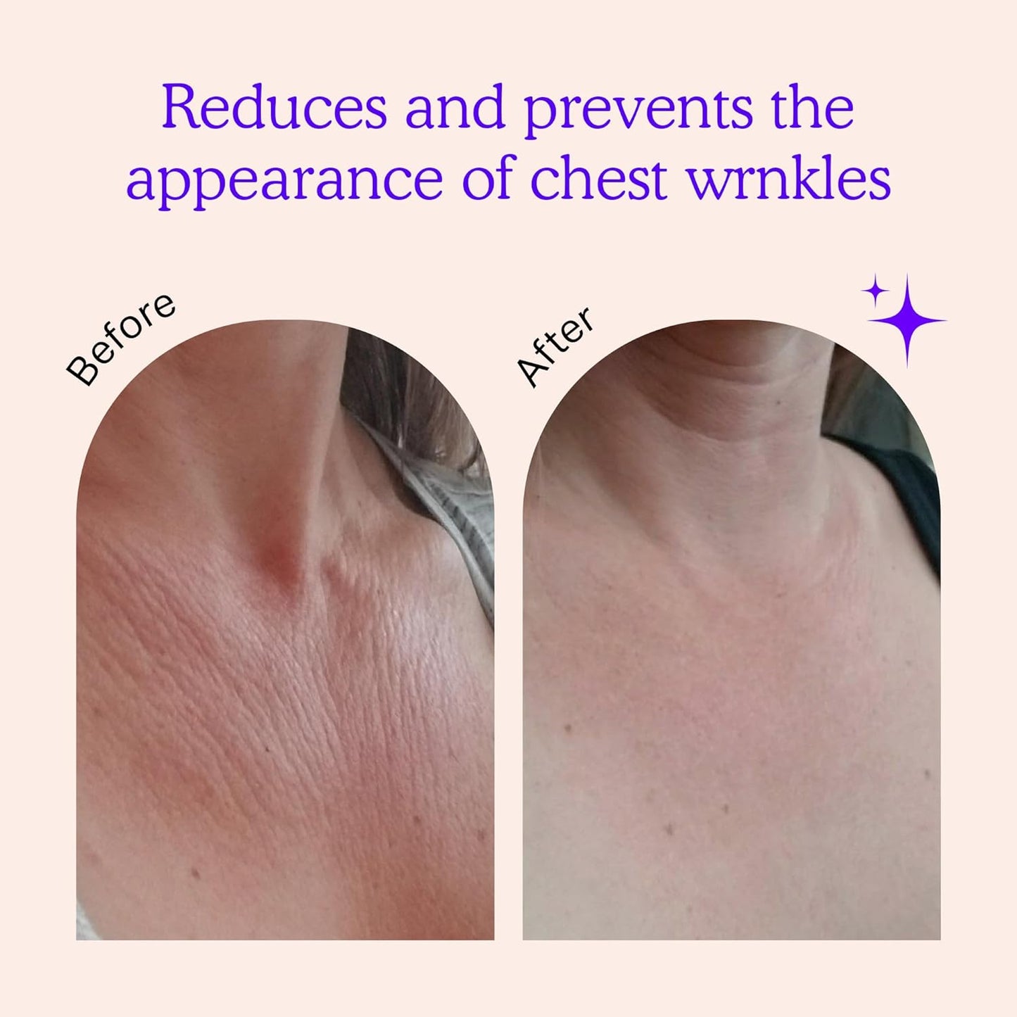 BLUMBODY Chest Wrinkle Pads – Anti-Wrinkle Silicone Patches Skin Firming, Smoothing – Reusable Overnight Chest Patches – Anti-Aging Crepe Erase Pads – Neck, Décolleté (2-Month Supply)