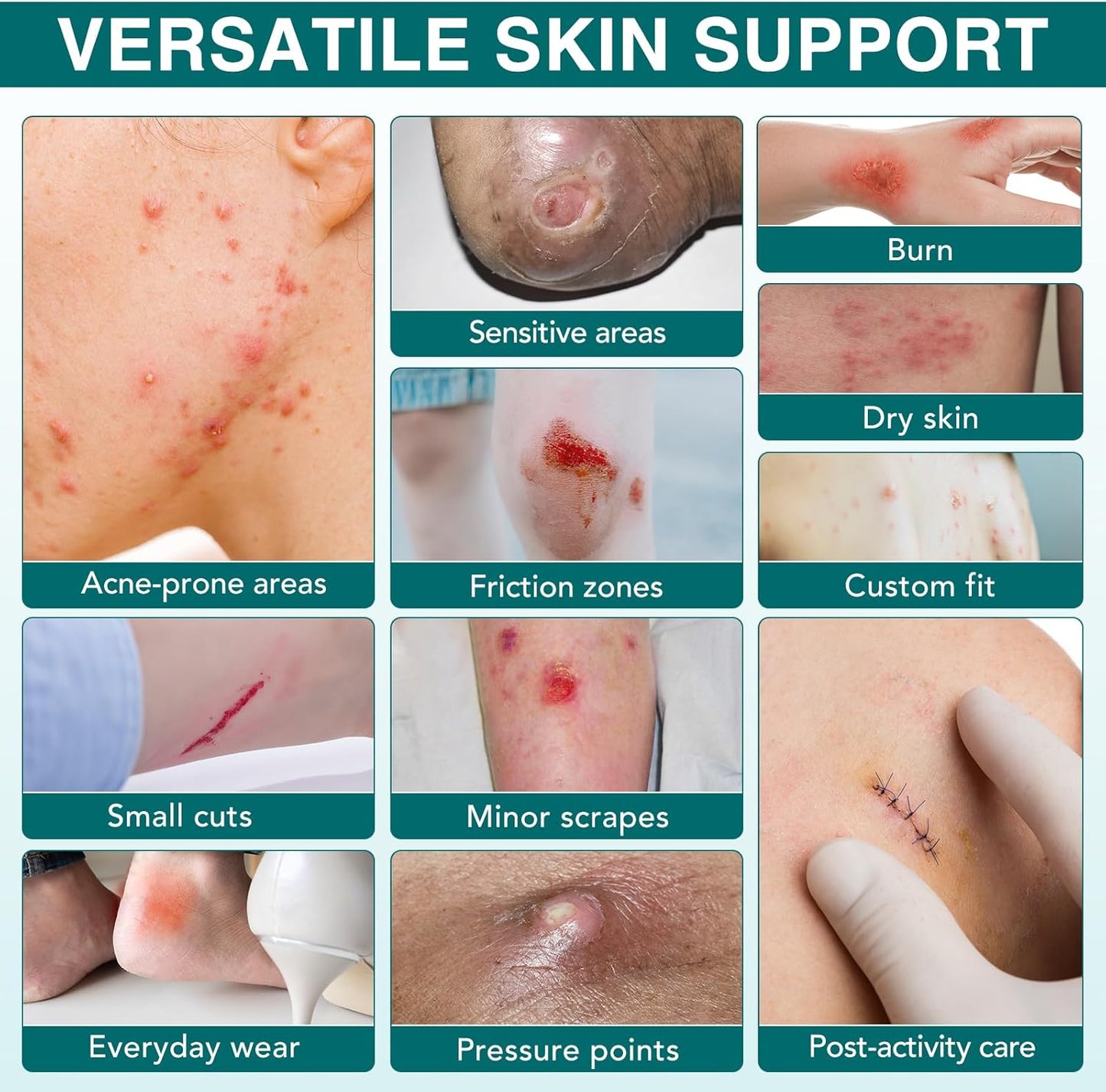 Hydrocolloid Roll for Skin Care,Cuttable Hydrocolloid Patch Bandages(2in*11.8ft),Hydrocolloid Roll with Self-Adhesive, Ultra Absorbent, Flexible & Waterproof