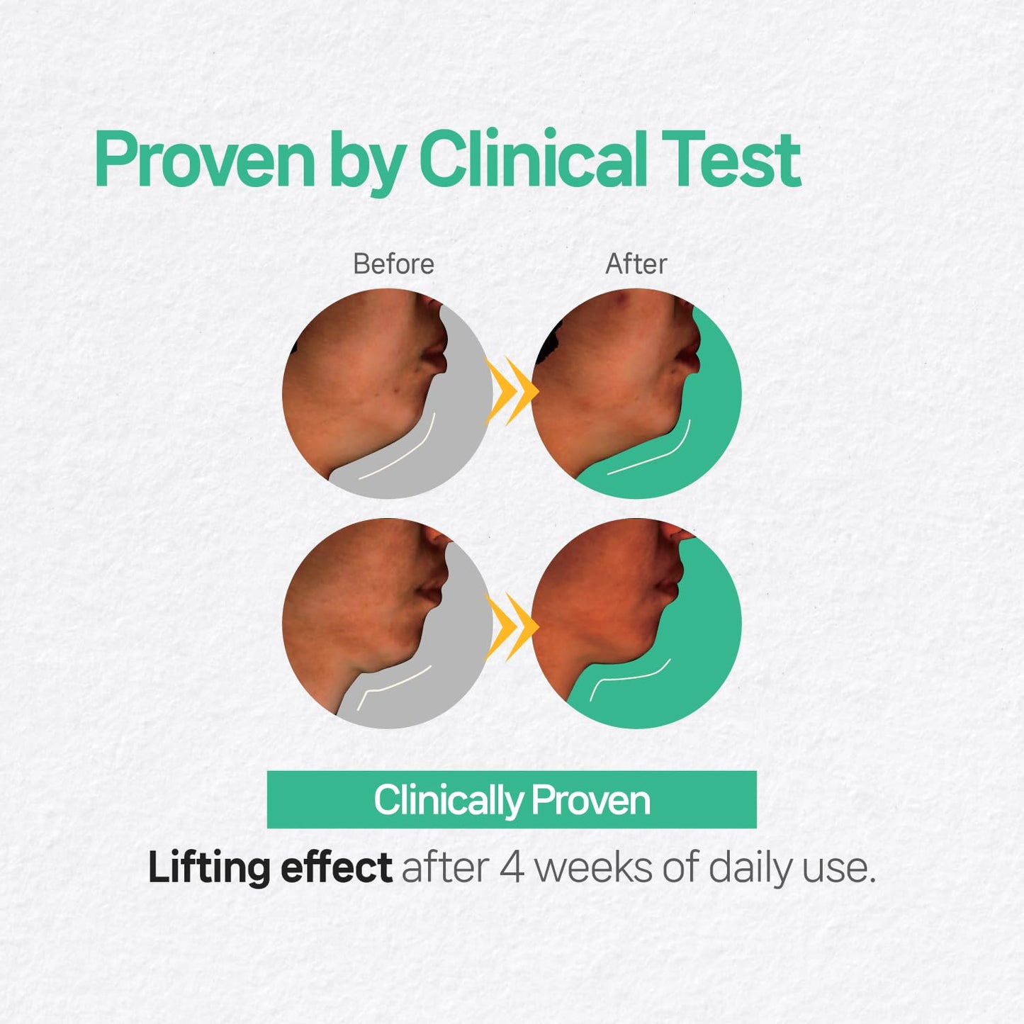 Labottach V Line Face & Neck Lifting Hydrogel Patches – 4pcs Collagen Mask for Jawline Contouring, Neck Wrinkle Care, Firming & Anti-Aging with Hyaluronic Acid and Vitamin E