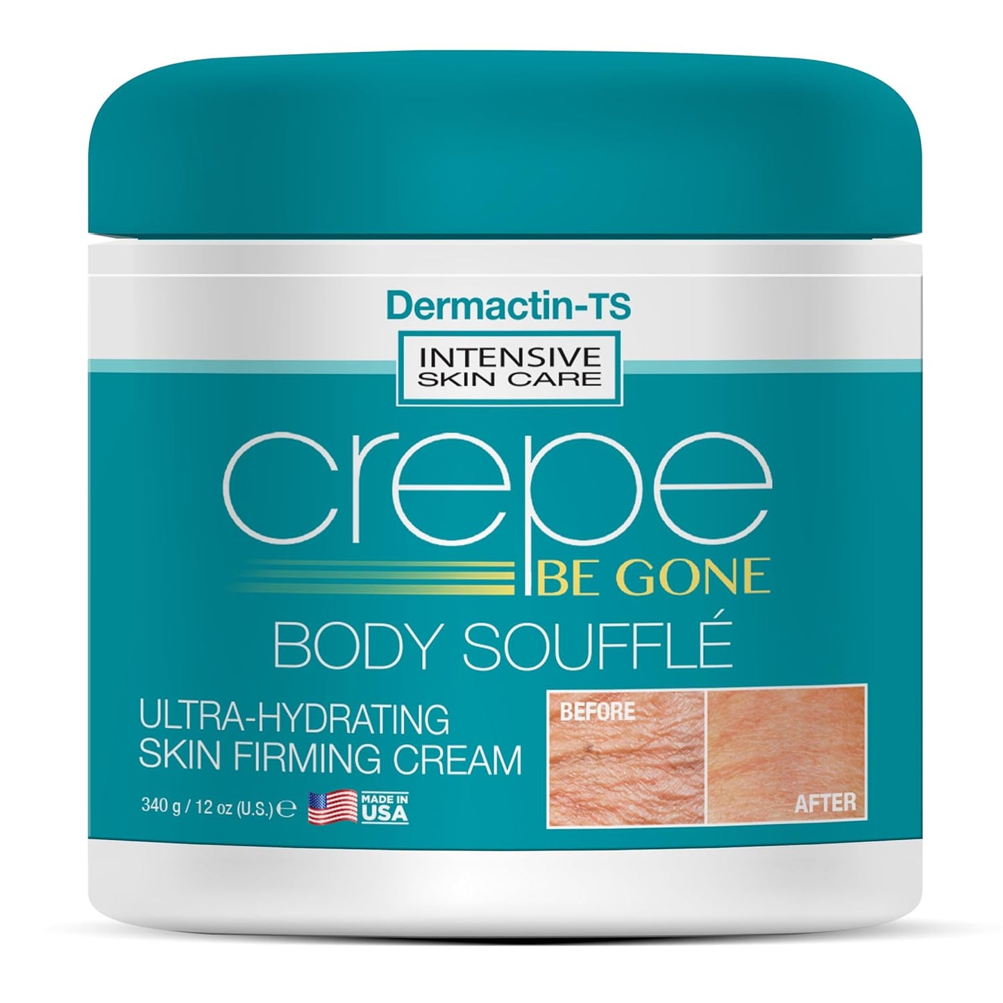 Crepe Be Gone Body Souffle Classic - Large 12 ounce - Ultra Hydrating Crepe Skin Firming Cream for Neck,Chest, Arms & Legs