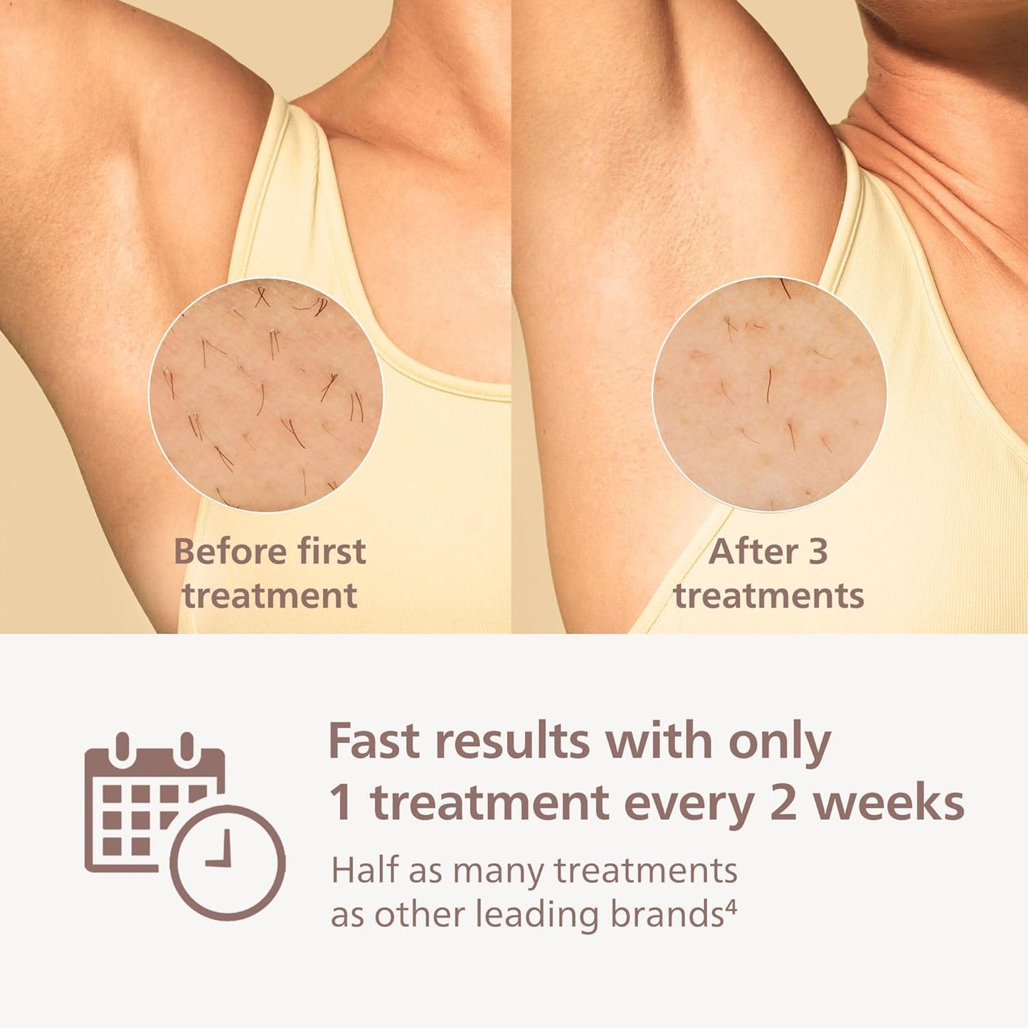 Philips Lumea 7000 Series IPL Hair Removal Device - Permanent Visible Hair Reduction Done at Home, SenseIQ Technology, Uniquely Curved Attachment for Body, for Women & Men, BRI931/03