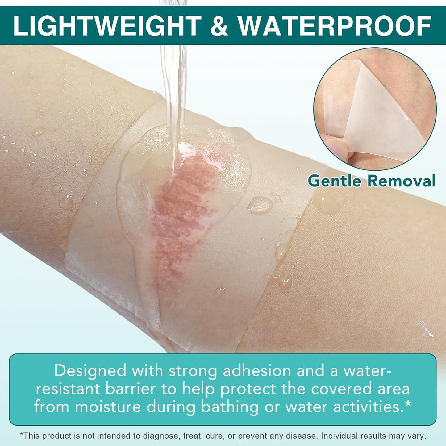 Hydrocolloid Roll 2in*11.8ft, Hydrocolloid Bandages for Wound Care, Flexible & Waterproof Cuttable Hydrocolloid Dressing Roll with Self-Adhesive