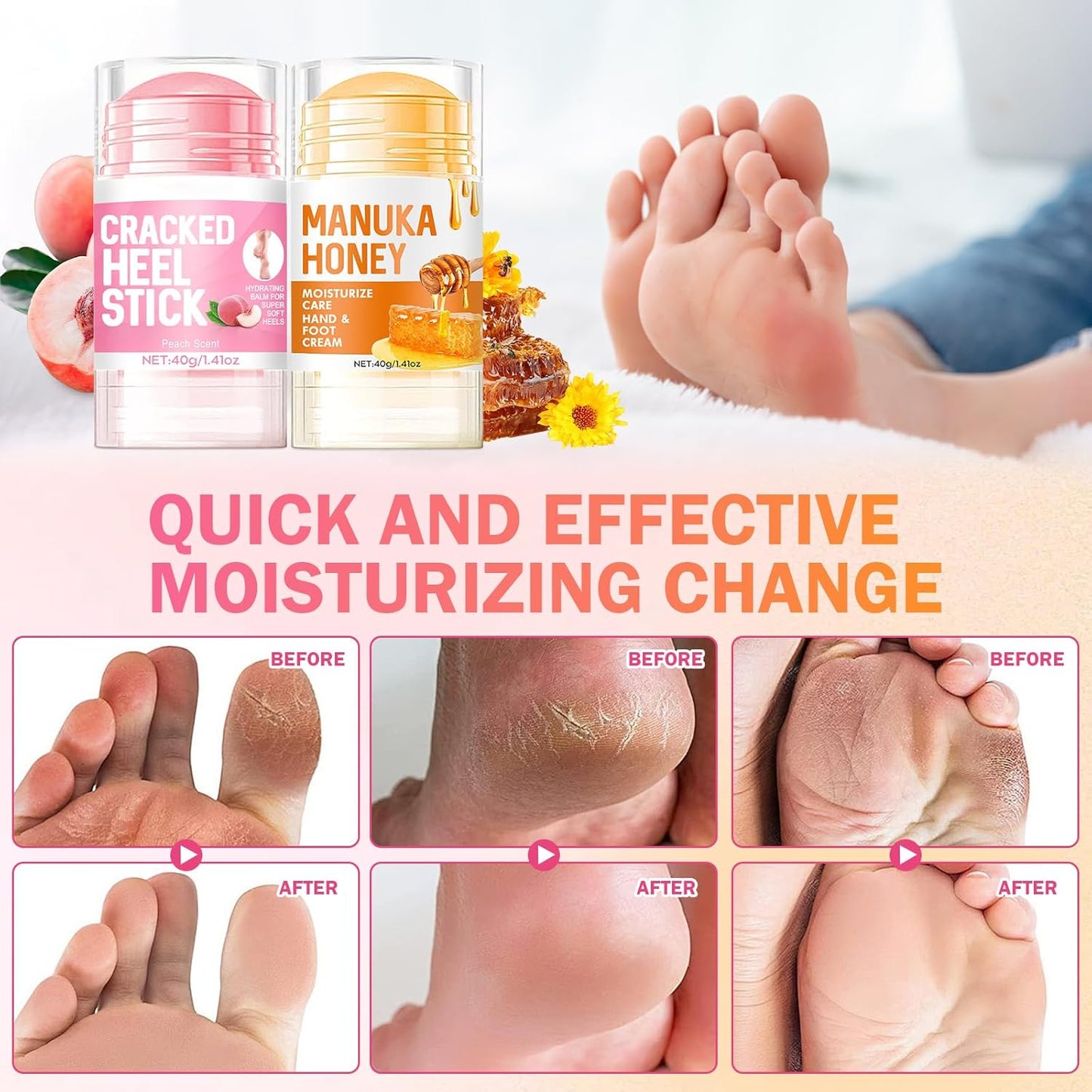 2PC Hydrating and Anti-Cracking Foot Cream, 2025 Upgraded Smooth Steps Foot Therapy Balm, Foot Cream for Dry Cracked Heels and Feet Women Men