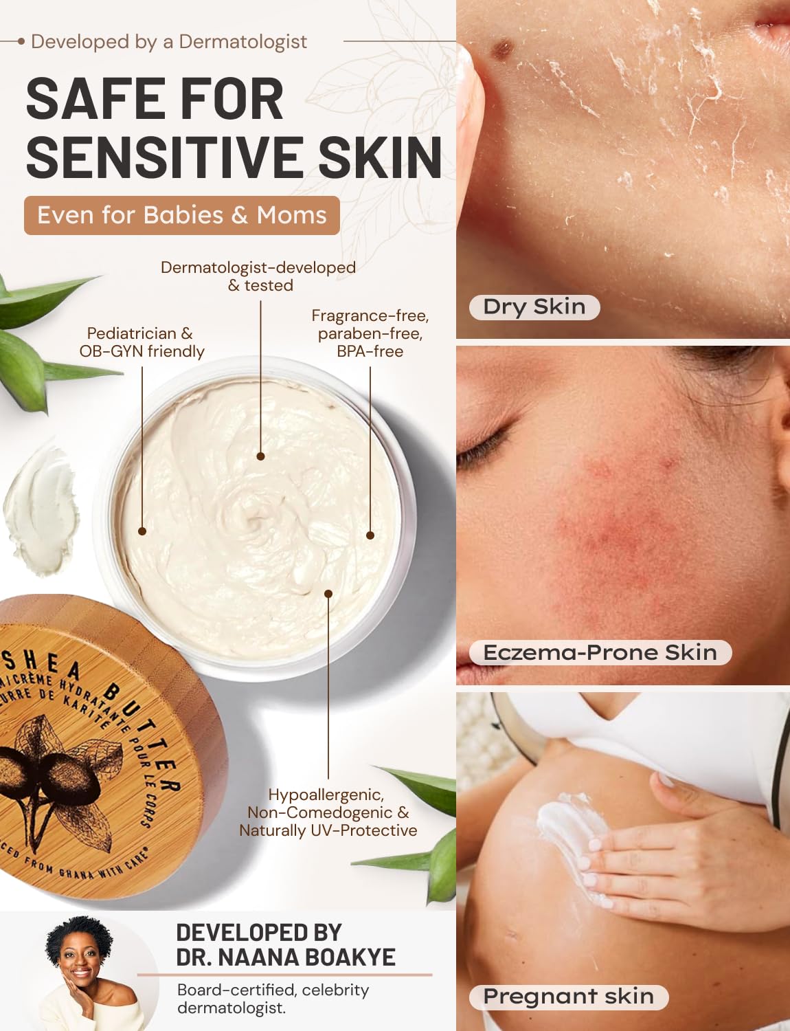 Karité Crème Corps Mini Shea Butter Body Cream | Hydrating Moisturizer for Dry & Sensitive Skin | Dermatologist-Formulated and Approved | Cruelty-free & Hypoallergenic for all Skin Types - 1.7fl oz