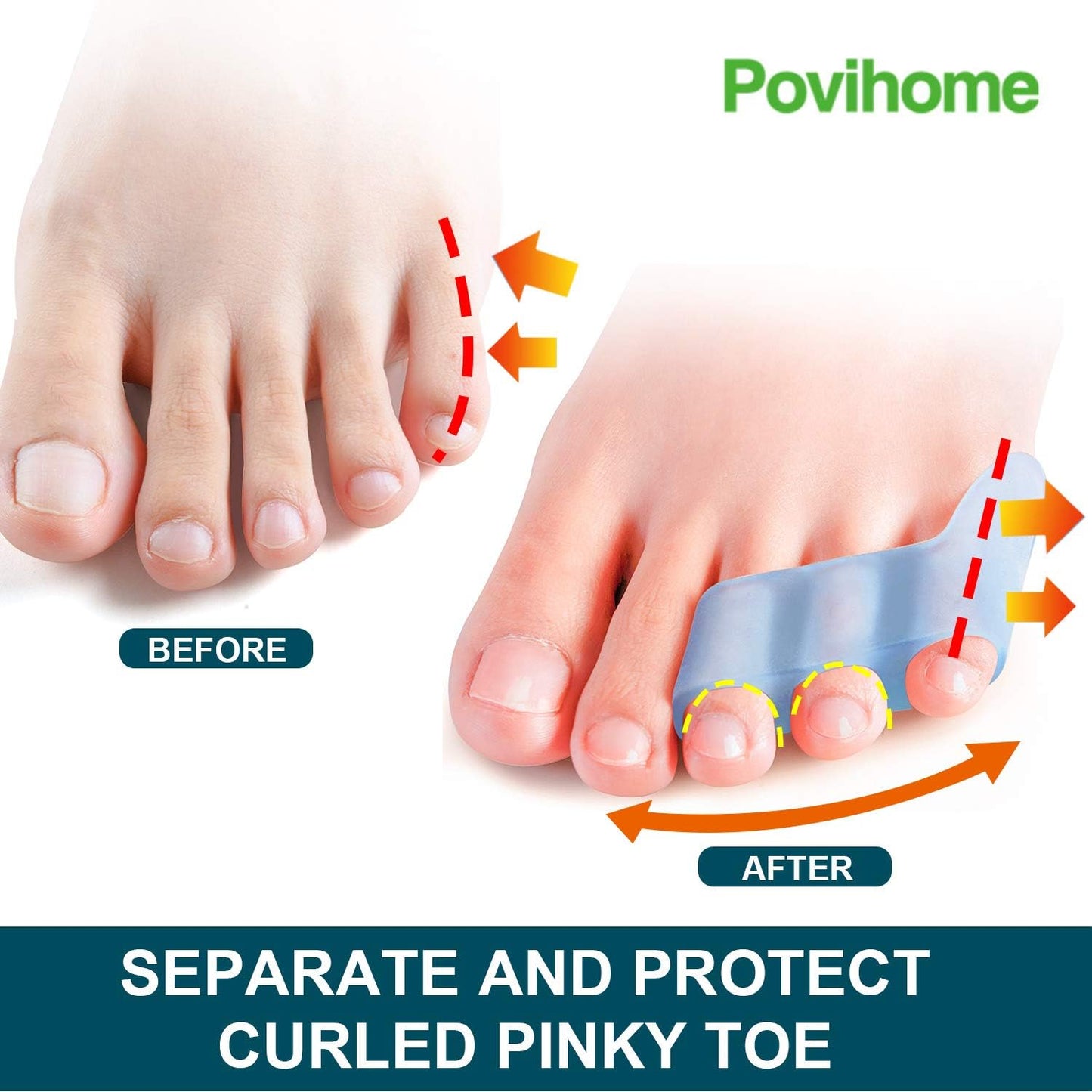 Povihome 10 Pack Pinky Toe Separator and Protectors for Overlapping Toe, Curled Pinky Toes - Spacers for Morton's Neuroma Pain Relief