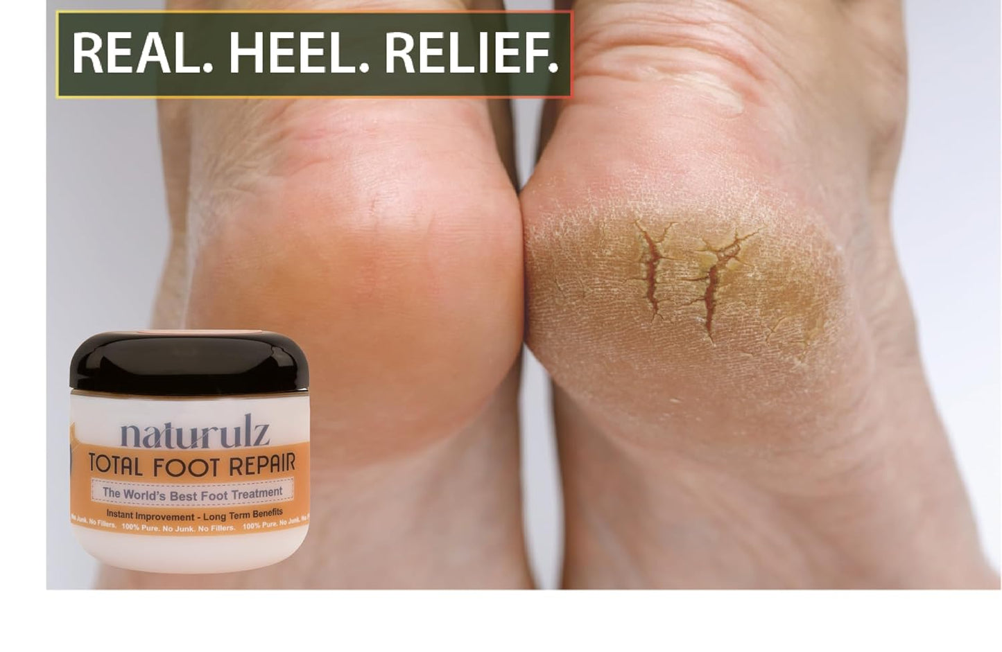 Naturulz Bundle and Save!!! - 2 Items - Ugli Butter Day & Total Foot Repair- Soothe Discomfort & Treat Dry Cracked Skin