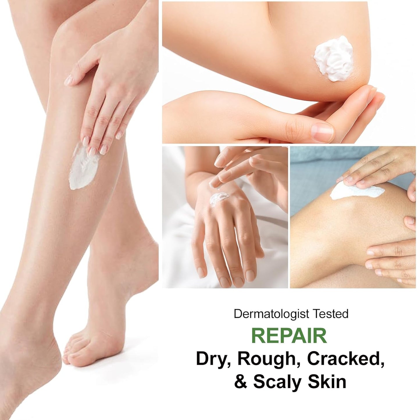 Urea Cream 60 Percent For Feet Maximum Strength Plus Salicylic Acid 2%, Tea Tree Foot Lotion For Dry Feetcracked Heels Treatment Athletes Foot Cream Intensive Repair Foot Moisturizer Care 5.29oz