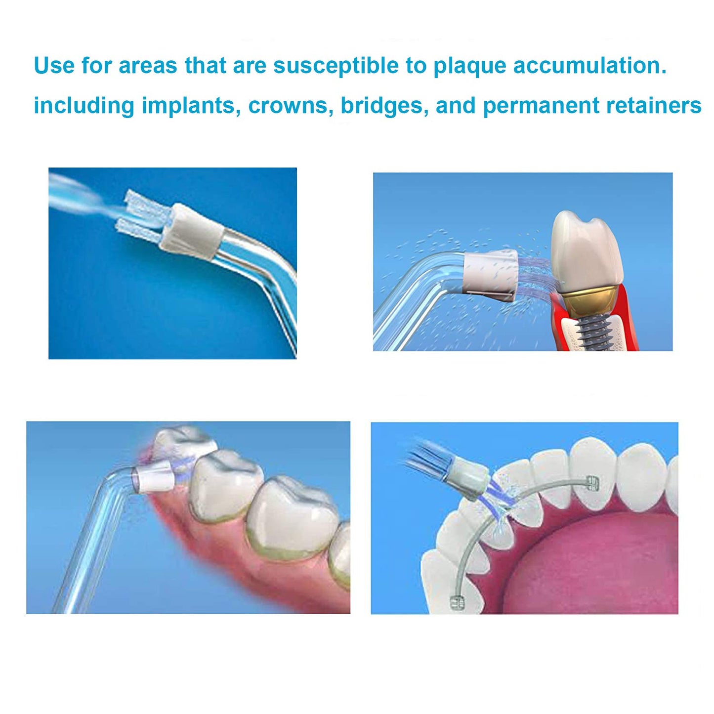 Flosser Replacement Tips Compatible with Waterpik Water Flosser, Reach Flosser Refill Heads Replacement Heads, Compatible with Waterpik Oral Irrigator & Dental Flosser (Plaque Tips)