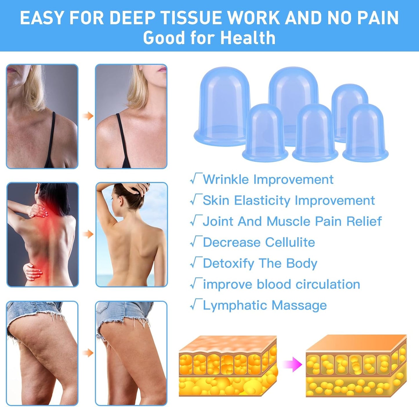 Silicone Cupping Therapy Set - Cupping Kit for Massage Therapy - Cellulite Remover Cupping Set - Anti Cellulite Cup Massager, Vacuum Suction Massage Cups for Cellulite Reduction