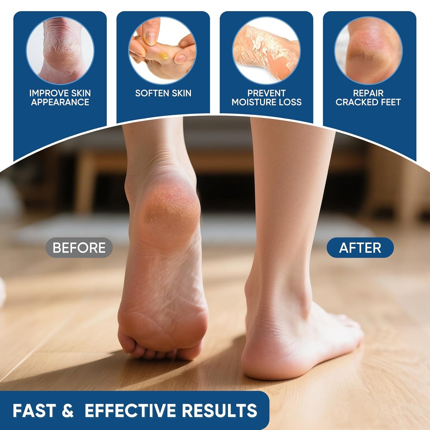 Urea Cream 40% Plus Salicylic Acid 2%, Urea Cream 40 Percent for Feet Maximum Strength, Foot Cream for Dry Heels Cracked