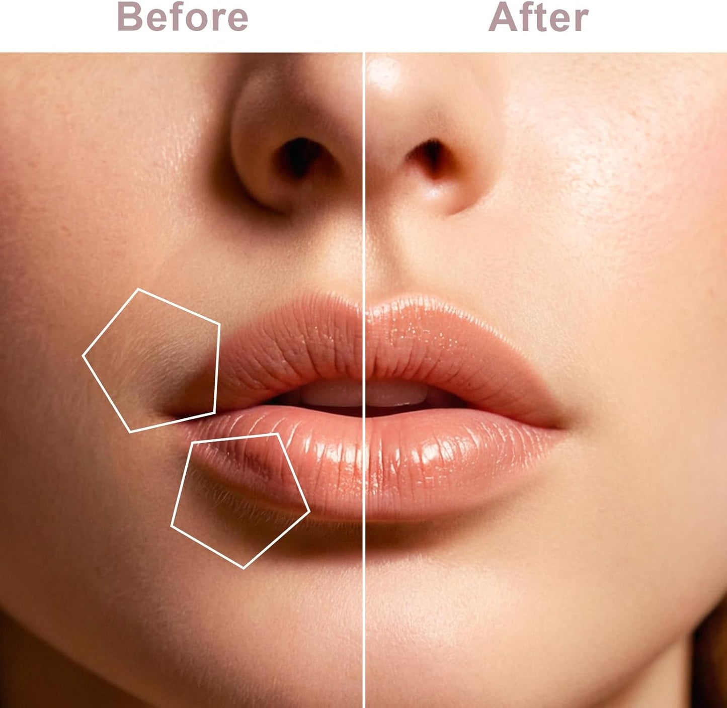 Facial Hair Remover for Women, Face Shaver for Women, Lady Face Electric Razor for Lip, Chin, Peach Fuzz, 2 Replacement Heads and USB Rechargeable