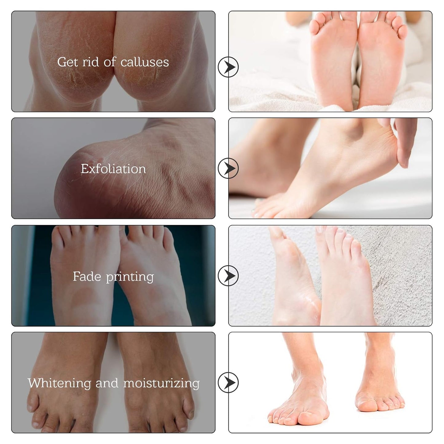 Foot Mask for Dry Cracked Feet, 3 Pairs Feet Peeling Mask, Foot Masks That Remove dead Skin, Callus Remover, Dry, Cracked Skin, Intensely Moisturizes Repairs, Spa Experience, Natural Exfoliator