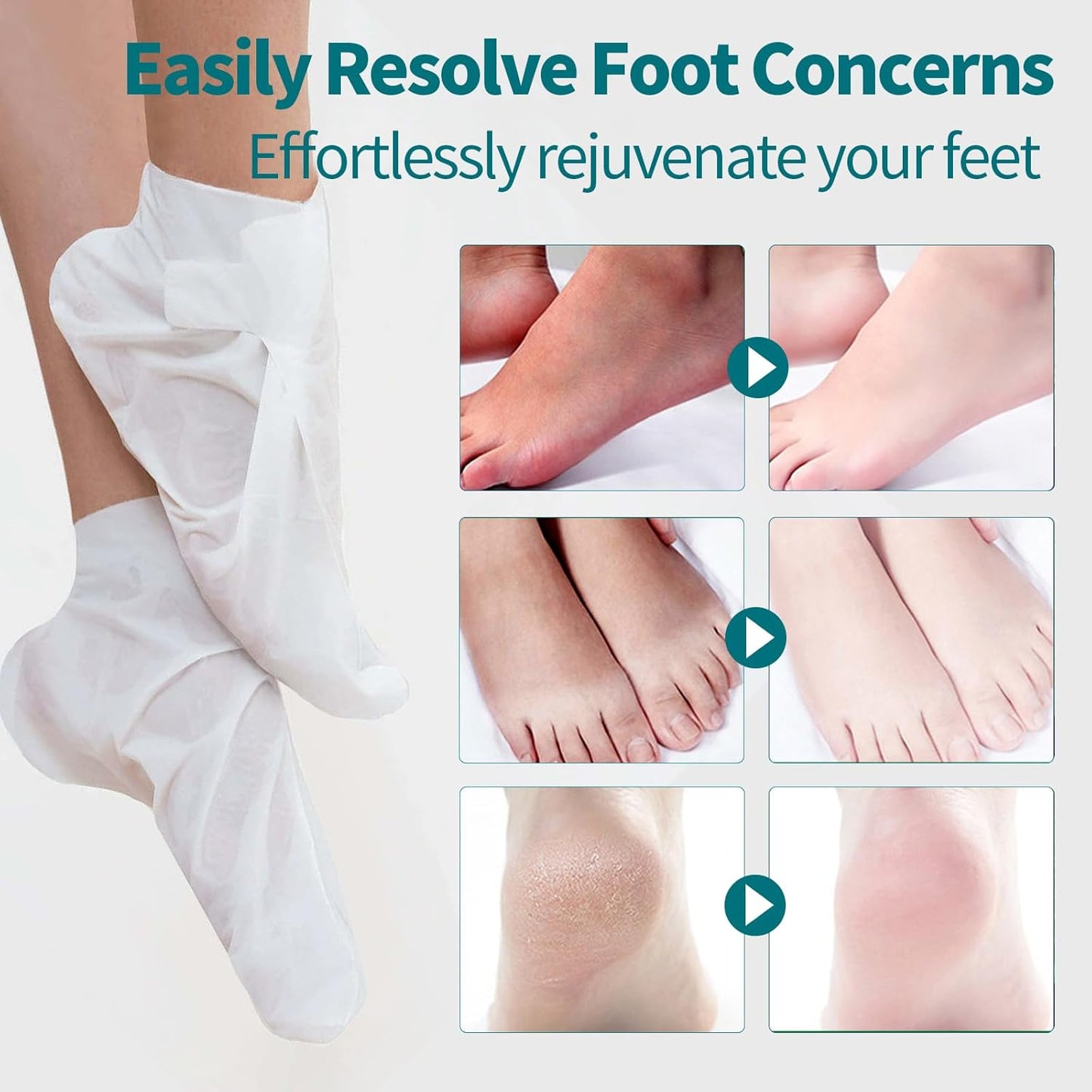 Moisturizing Foot Mask 5 Pack,Hydrating Foot Masks for Dry Cracked Feet,Moisturizing Socks Dry Skin Moisturizer for Soft and Smooth Touch Feet,Foot Care Spa Gifts for Women Men Stocking Stuffers