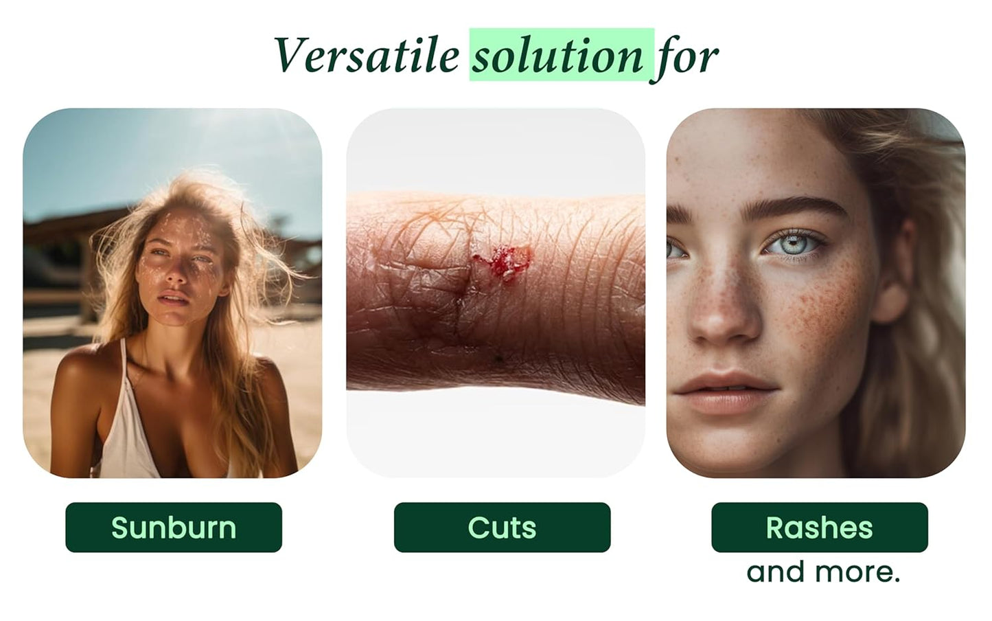 99.75% Pure & Organic Aloe Vera Spray, Clinically tested & Dermatologist approved, Hydrates & Heals Dry & Damaged Skin & Hair- 12 Oz