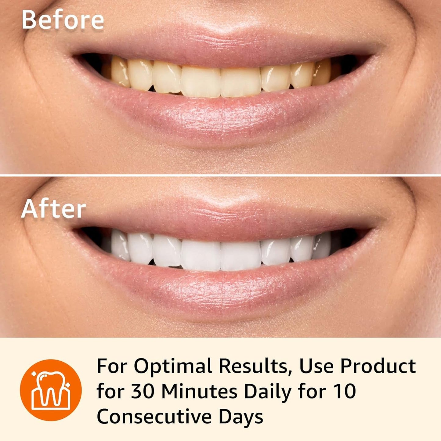 Amazon Basics 10 Day Teeth Whitening Strips Kit, 10 Treatments, 1-Pack (Previously Solimo)