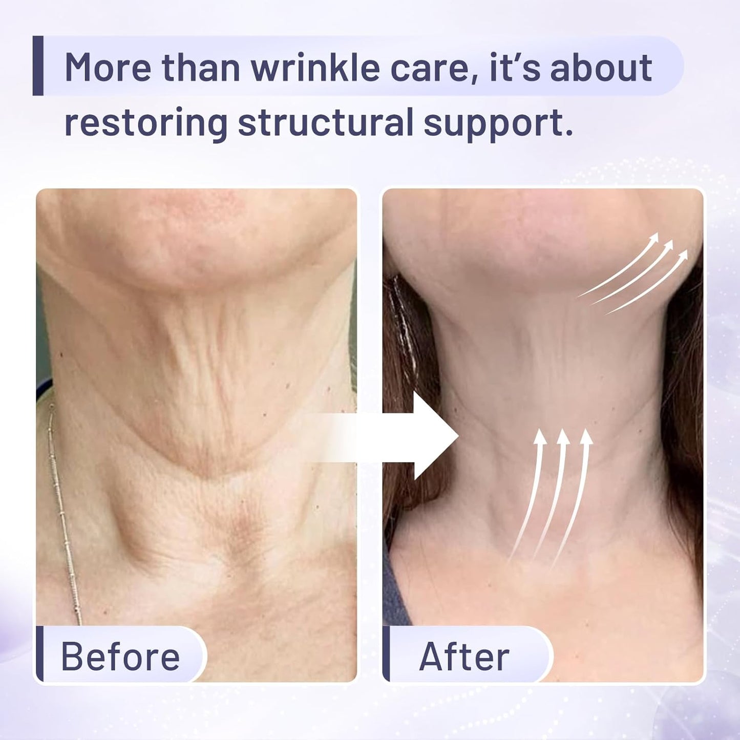 Premium Neck Firming Cream – Lifting & Tightening Treatment for Décolleté and Chest, Anti-Aging Neck Cream Reduces Fine Lines and Sagging, Gift for Women & Men, 2.03 Fl Oz