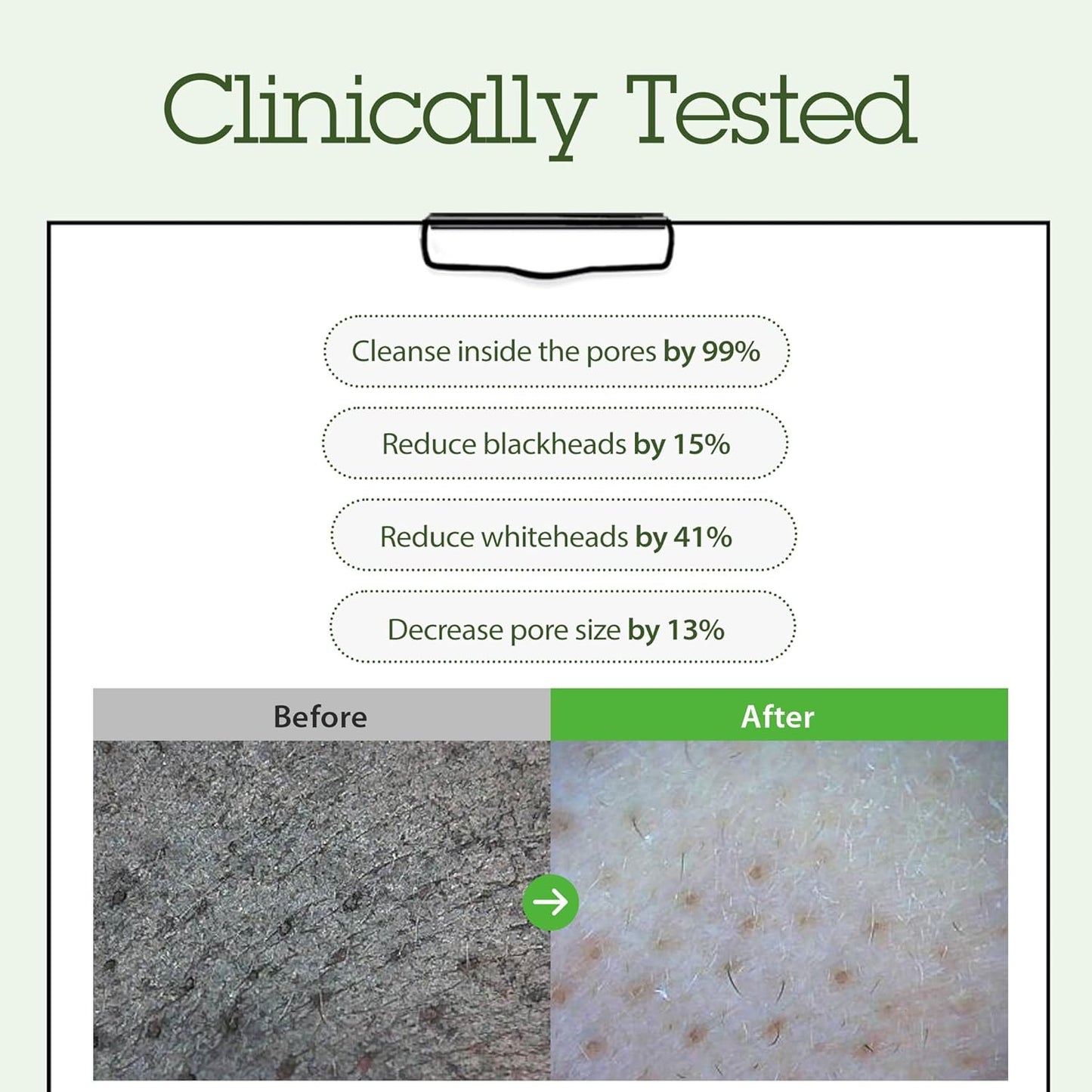 BLITHE Cleansing Balm, Pore Cleansing Makeup Remover Balm, Hygenic Design, Korean Makeup Remover