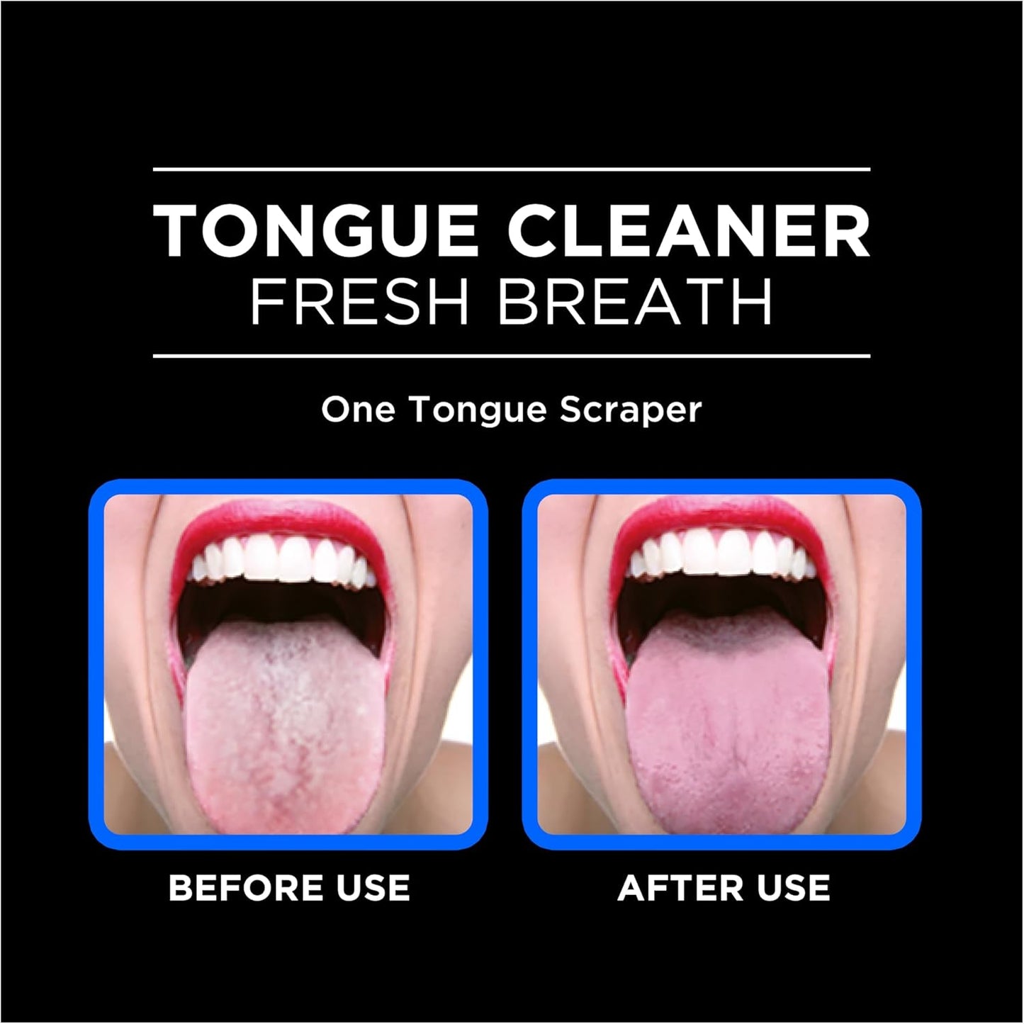 DenTek Orabrush Tongue Scraper, Gentle Tongue Cleaner Brush for Fresh Breath, 2 Count