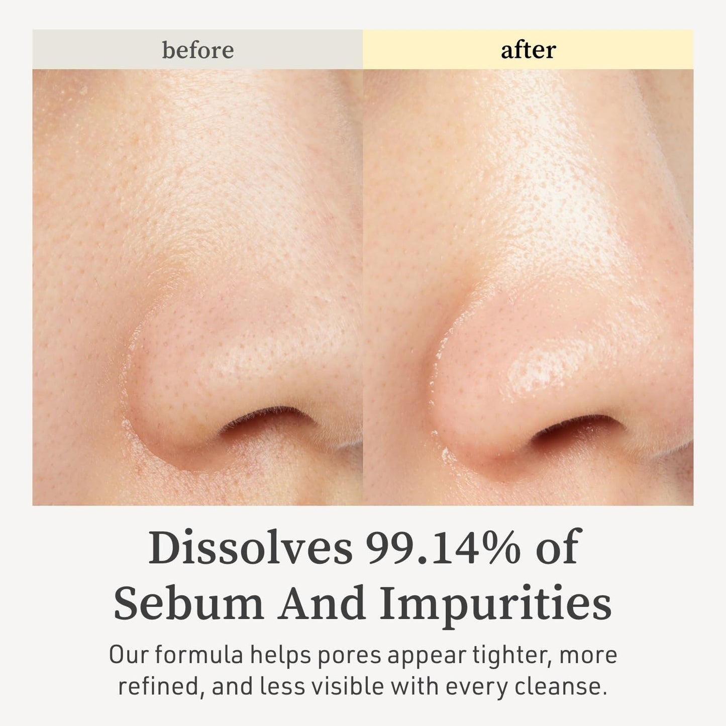 NOONI Korean Cleansing Oil - Snow Aqua 0 LHA Toning Cleansing Oil | Makeup Blackhead Remover, Pore Control, Glass Skin, Help Control Sebum, Revitalizing, Moisturizing, Korean Skin Care, 6.76 Fl Oz