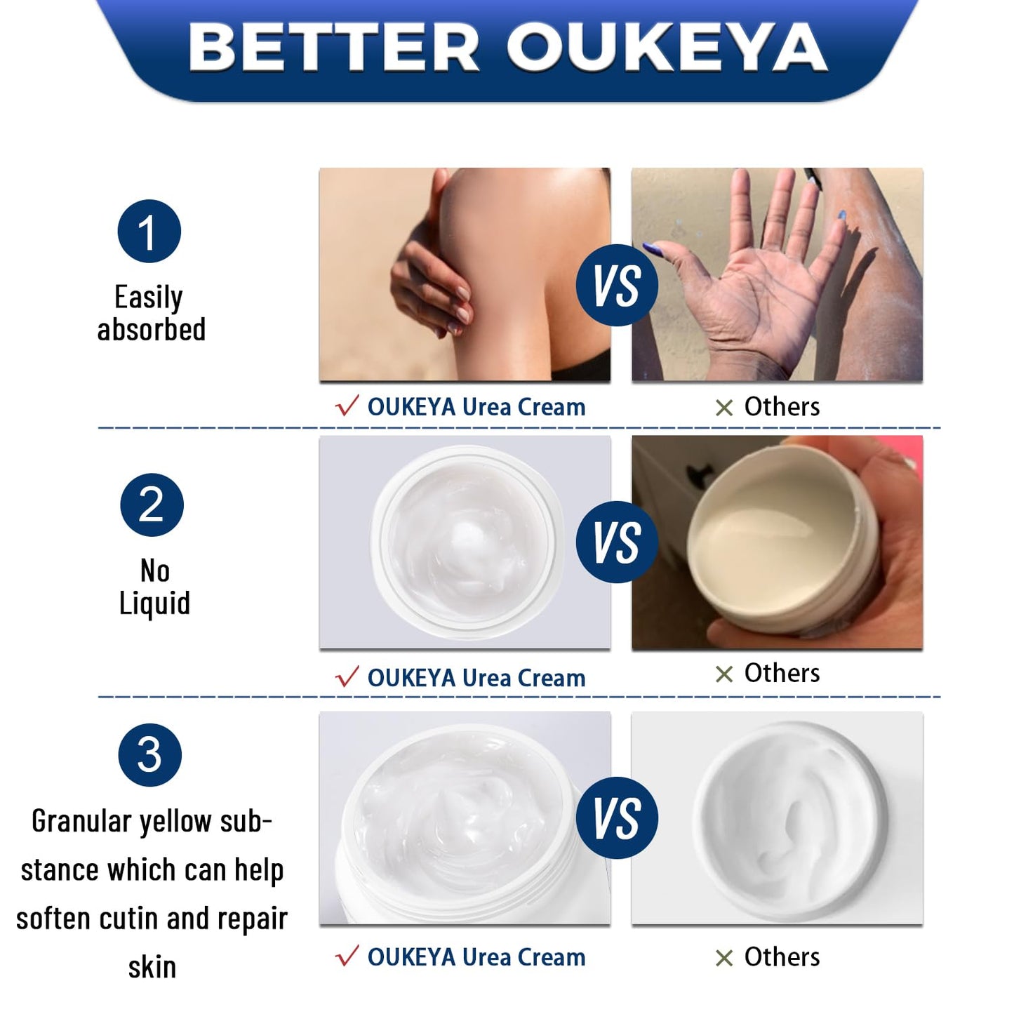 OUKEYA Urea Cream 40 Percent, Foot & Hand Cream for Dry Cracked, Urea Lotion for Feet Maximum Strength(12.35Oz)