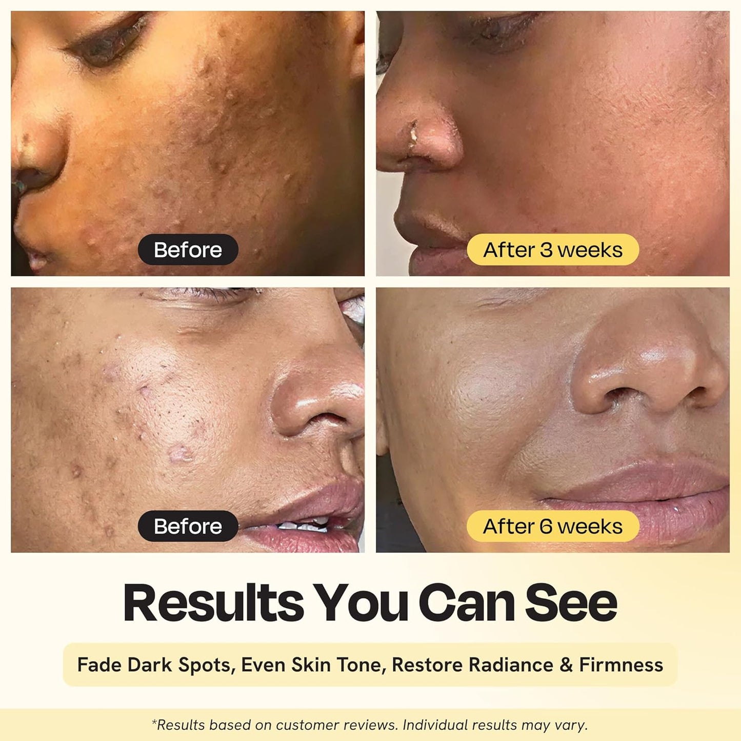 Gleamin Superactive Vitamin C Serum for Face with 15% Vitamin C, Niacinamide, Bakuchiol & Hyaluronic Acid – Skin Brightening Facial Serum for Women & Men – Dark Spot Remover & Radiant Glow – 1 fl oz