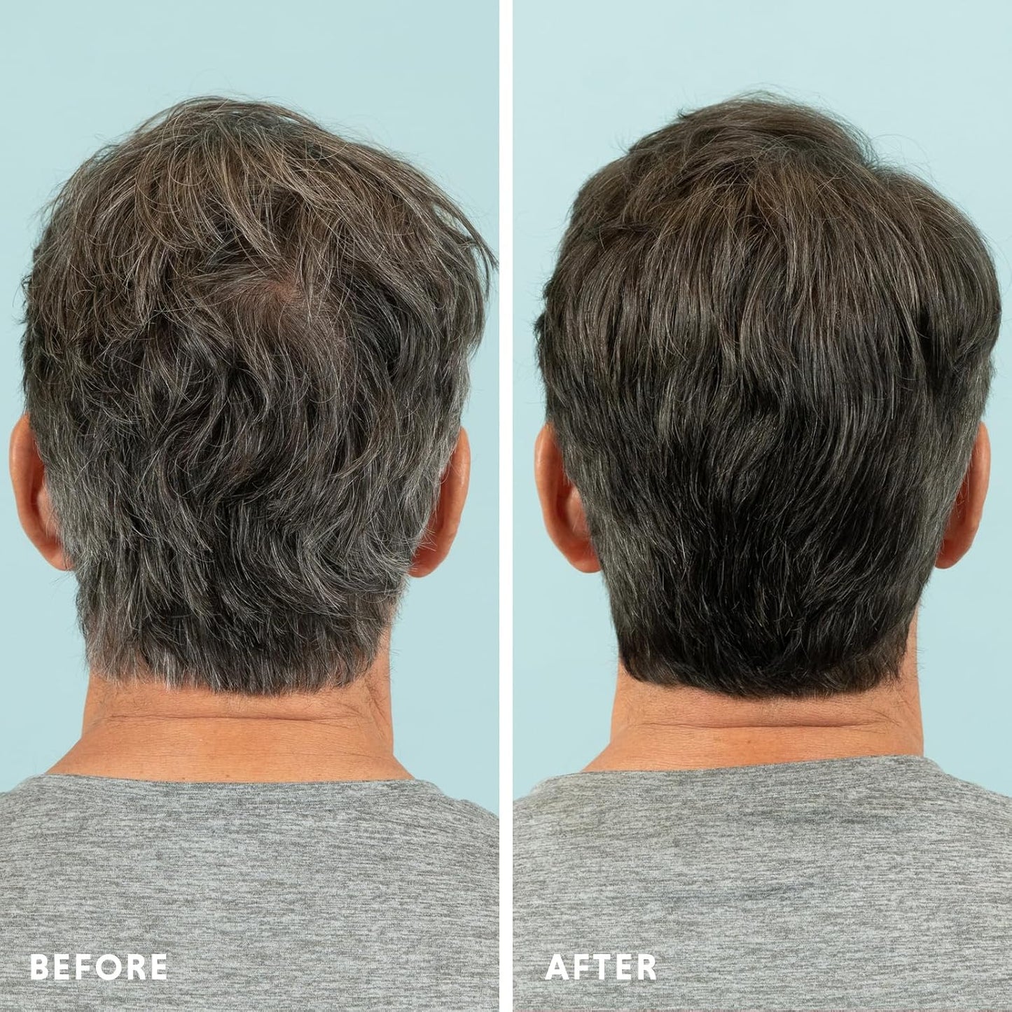 Hair & Beard Color for Blending Grays 2 pack - Medium Brown - Ammonia-Free Complete Men’s At-home Beard & Hair Dye Kit, Professional-grade Demi-Permanent Hair Color (5.0)