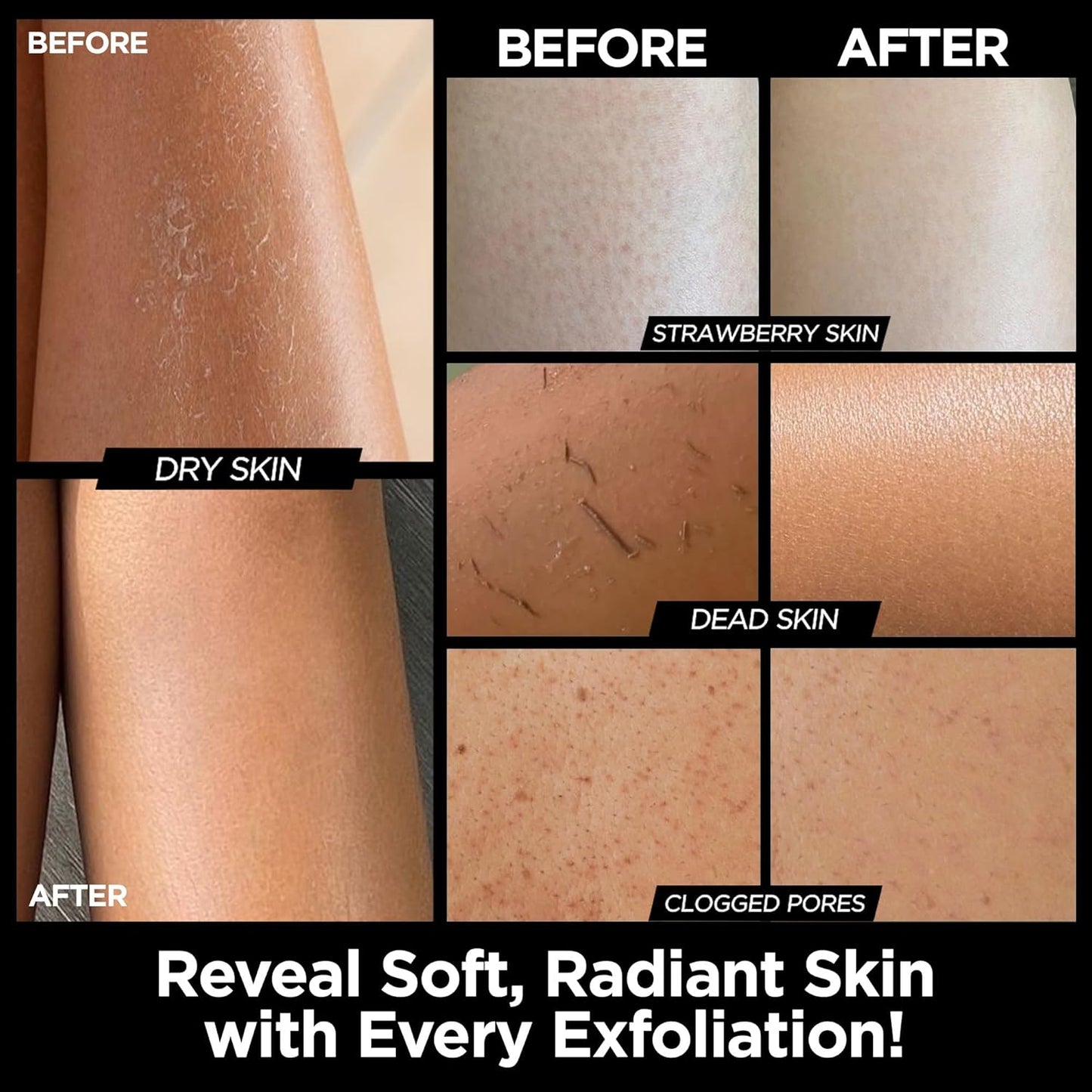 Exfoliating Glove Kessa Mitt Body Scrubber - Dead Skin Remover Shower Glove for Dead Skin Scrubbing and Deep Pore Cleansing - by MoroccanSource (3 Piece spa Set)