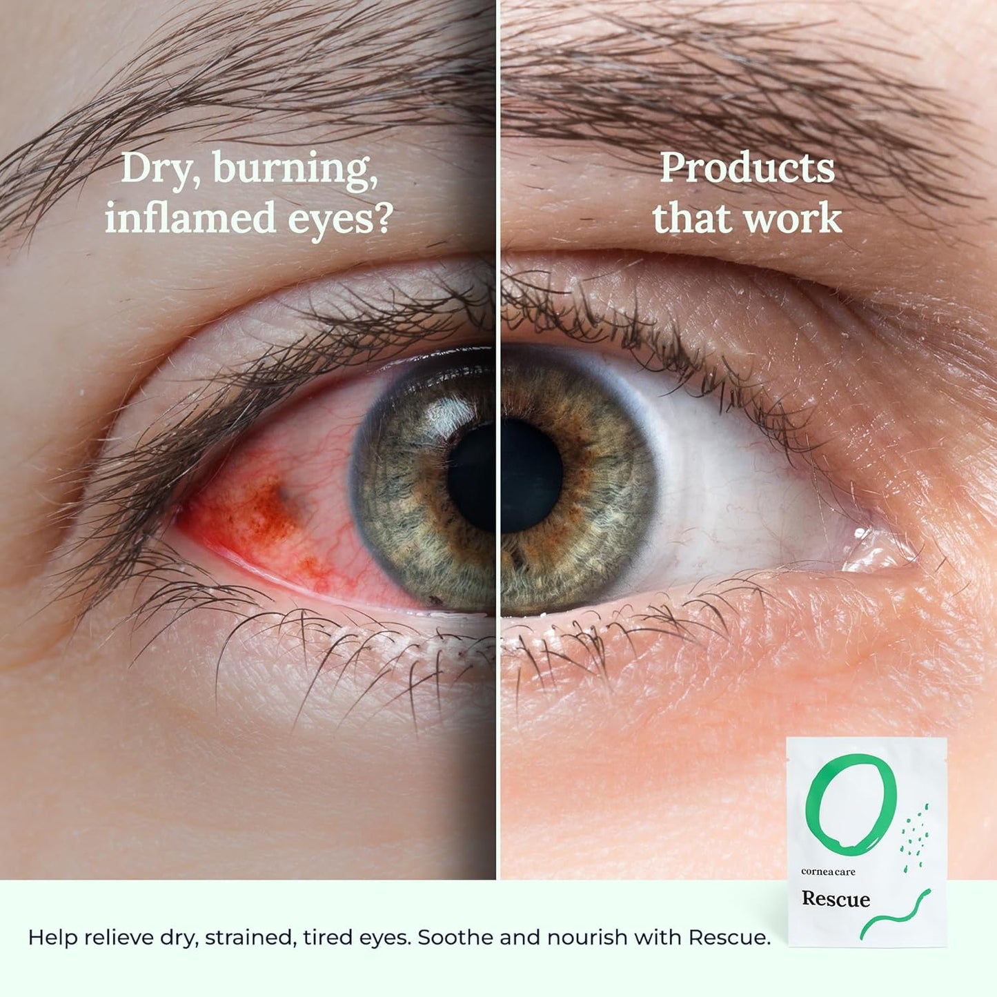 Rescue: Hydrogel Self Cooling Compress | Cold Eye Masks for Puffy Eyes | Self Cooling Eye Compress for Fast Relief | Travel Ready | 6 Count