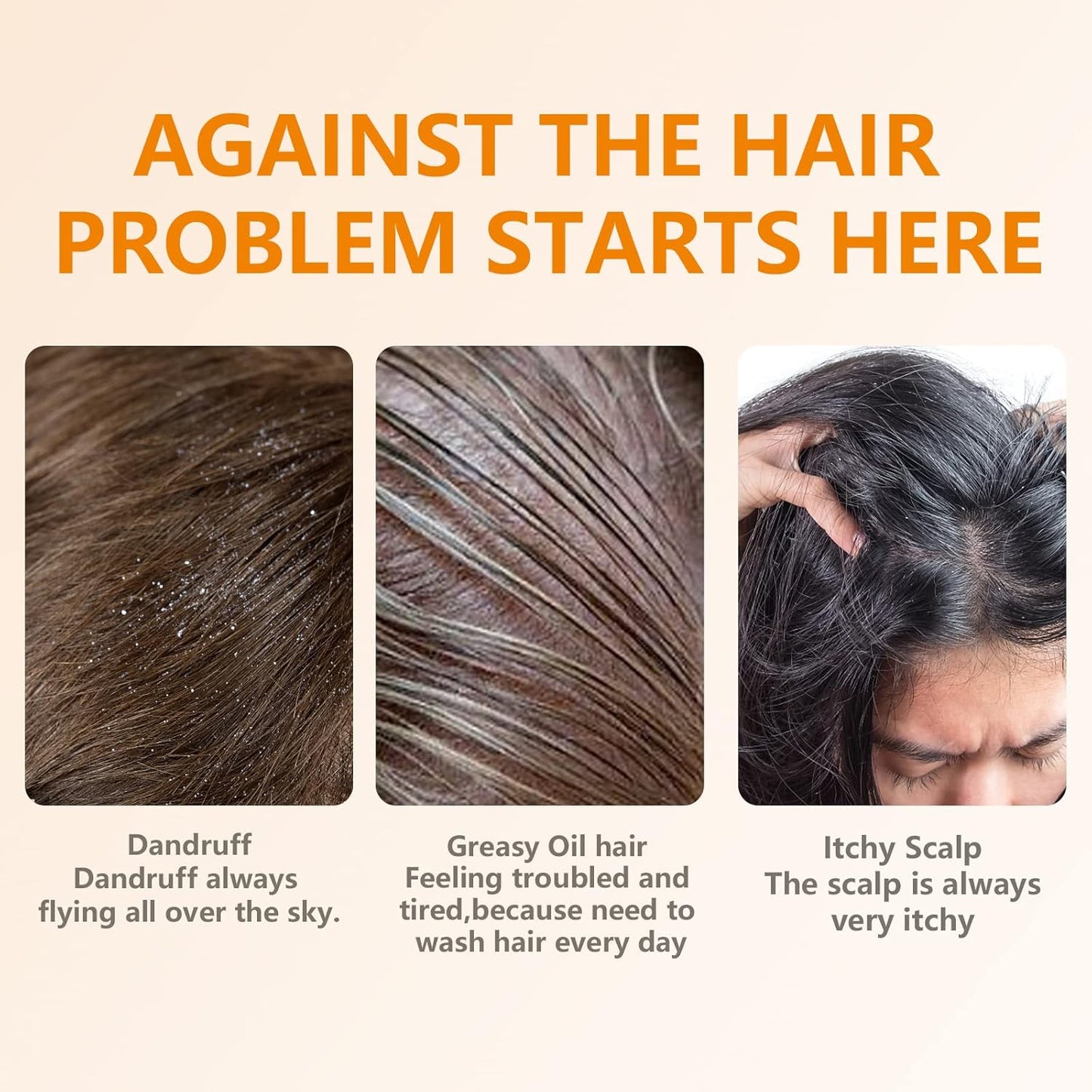 2 Pack Ginger Hair Regrowth Shampoo Bar Turmeric Soap for Hair Growth Natural Ginger Solid Bars for Thinning Strengthen Curly Oily Hair Anti Hair Loss Travel Deep Cleansing Women Men 4.23OZ/120g