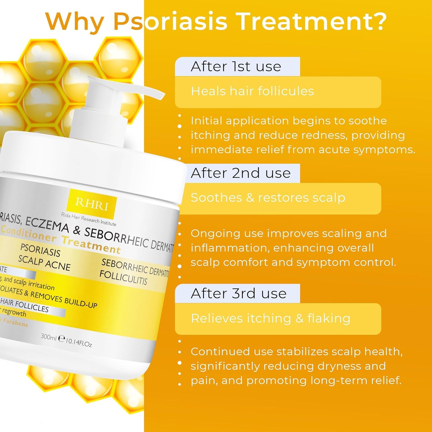 Anti Fungal Psoriasis Conditioner for Psoriasis, Eczema & Seborrheic Dermatitis | With DHT Blockers, Mineral Complex & Tea Tree Oil | Soothes Dry Itchy Scalp & Supports Hair Growth for Men & Women