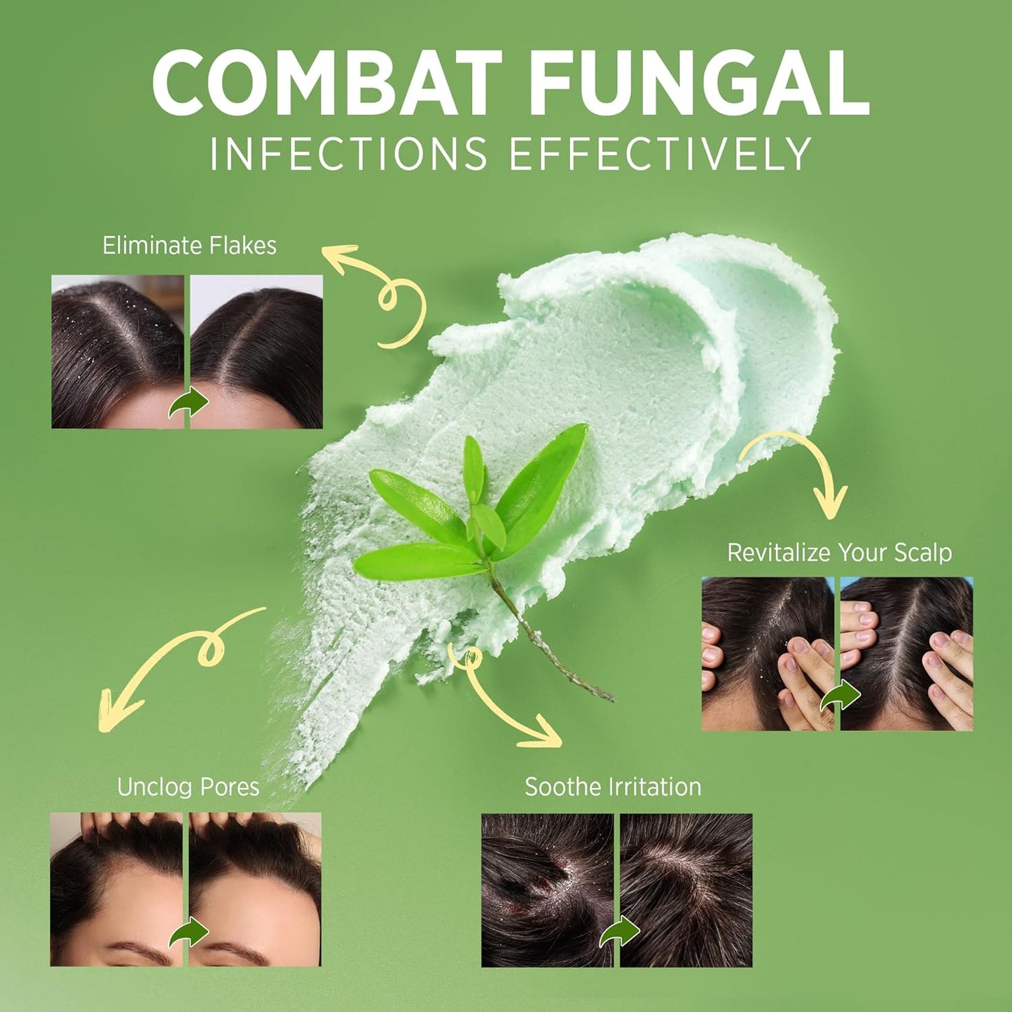 Roycederm Tea Tree Scalp Scrub with Scalp Massager Brush - Deep Cleansing, Itchy Relief Scalp Treatment for Dandruff, Psoriasis & Seborrheic Dermatitis - Gently Exfoliator, Relieves Dryness