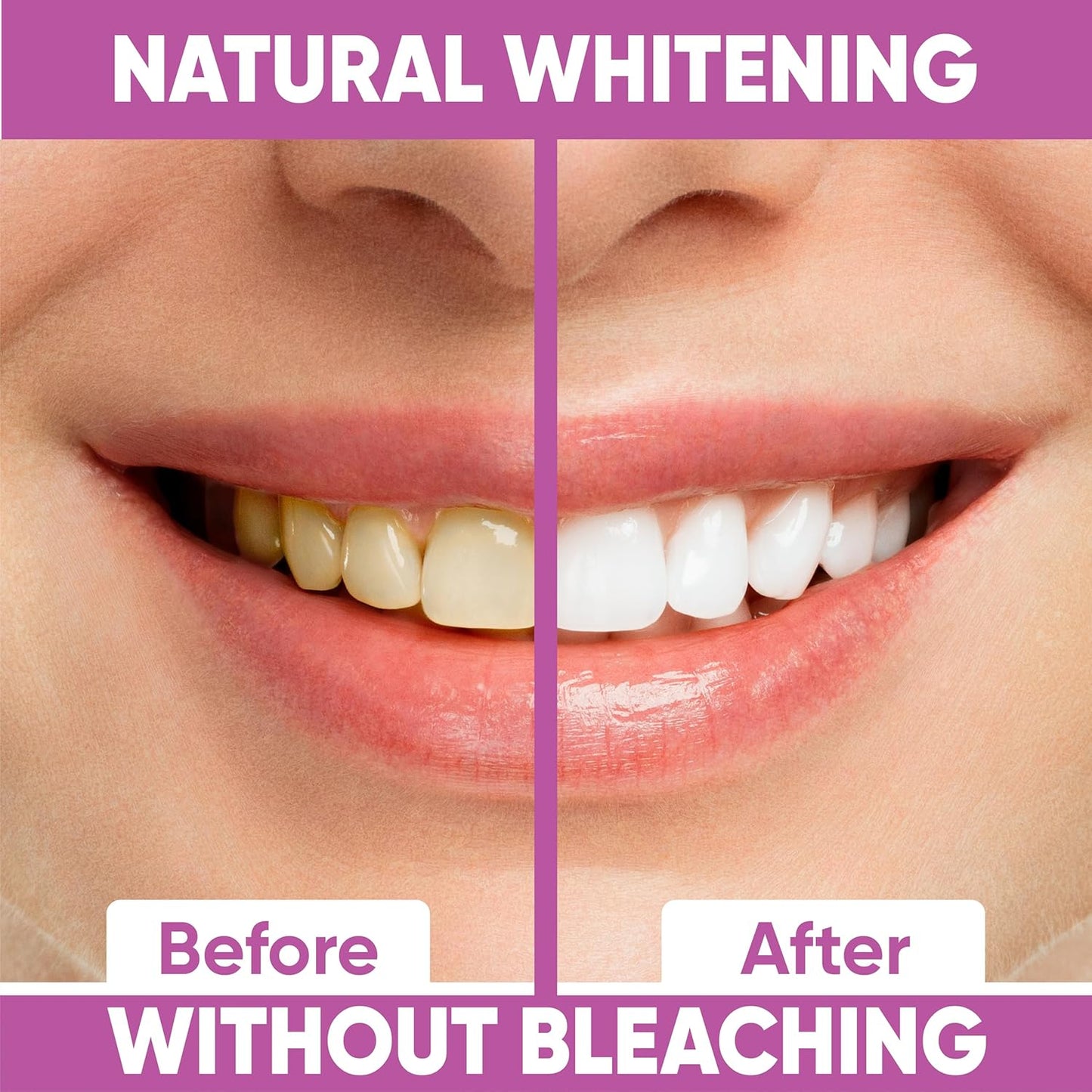 Gentle Teeth Whitening Strips - (28 Stripes) Bleaching Teeth Free of Peroxide for a Radiant Smile - Gentle Tooth whitening