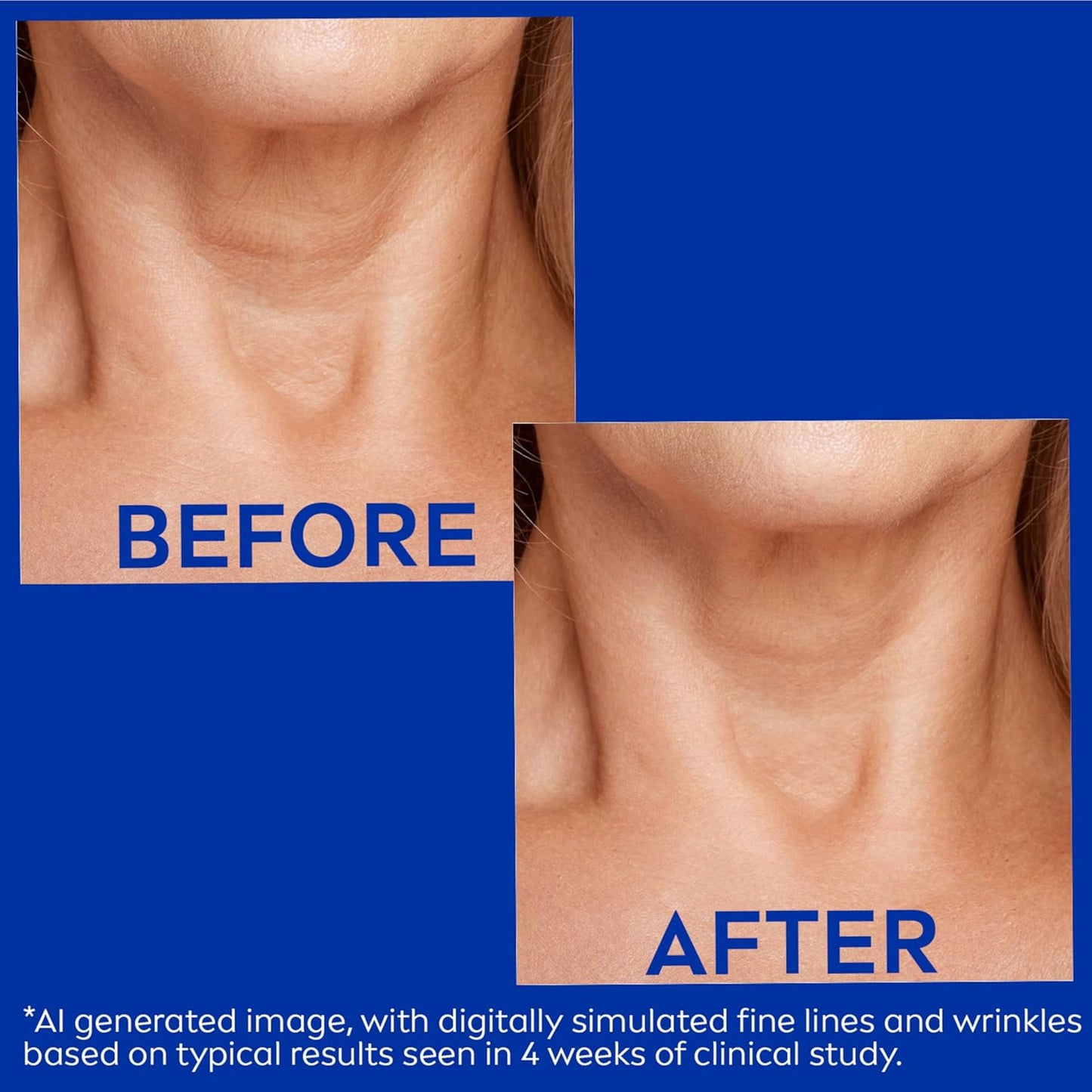 Nivea Skin Firming and Anti Wrinkle Neck and Chest Cream with Q10, Creatine and Provitamin B5, Skin Firming Body Cream Reduces the Look of Fine Lines and Wrinkles, 6.7 Oz Tube