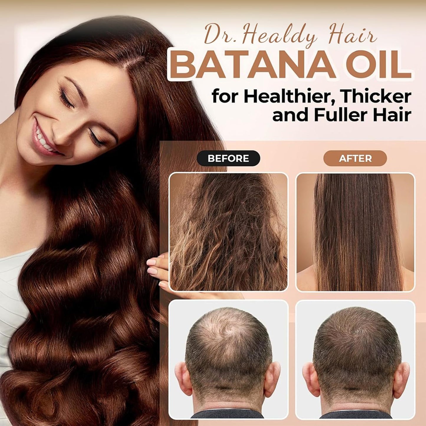 Batana Oil Shampoo and Conditioner Set - for Hair Growth,Thickening & Hydration,Sulfate Free - Fights Hair Loss & Clarifies Scalp -Root Activator Shampoo for Men (6.8 Fl Oz×2)