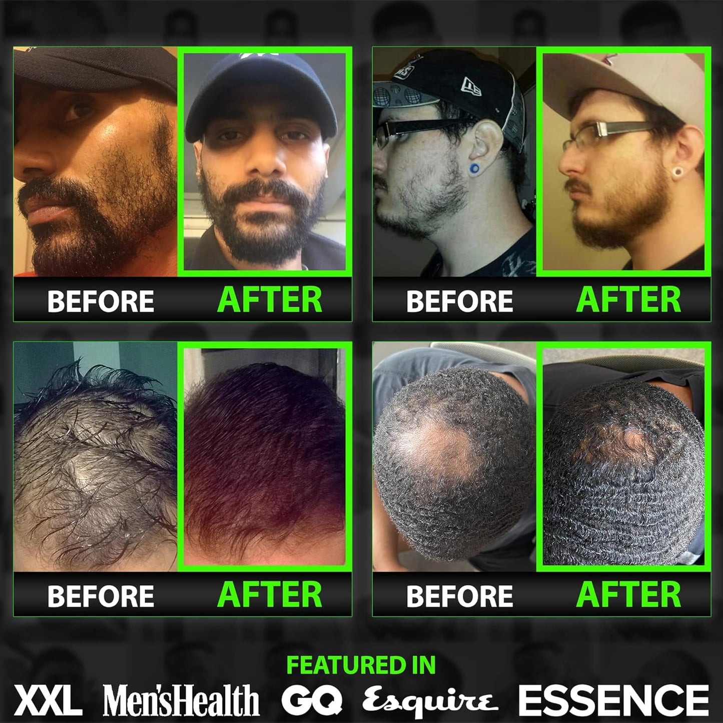 Biotin Beard Balm + 11-in-1 Beard & Hair Growth Shampoo – Kit with Castor Oil, Peppermint & Keratin – 2X Thickening Balm, Mustache Wax & Conditioner – Hydrates, Thickens & Softens